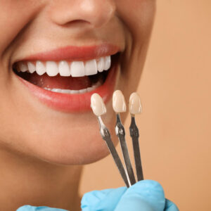 Jovem sorrindo e destacando a dentição, muito branca